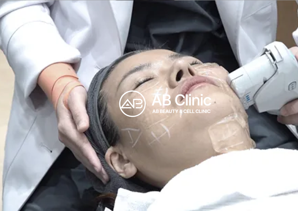 韩国AB皮肤科治疗照片