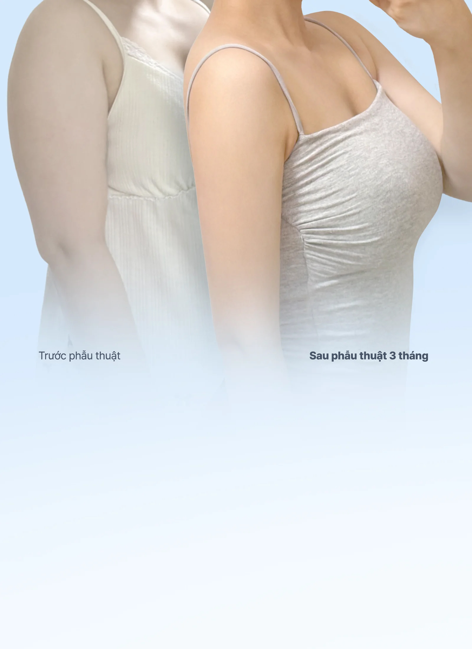 Arm liposuction before and after comparison