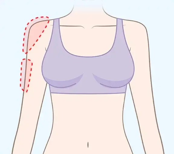 Uneven arm line with partial bulges