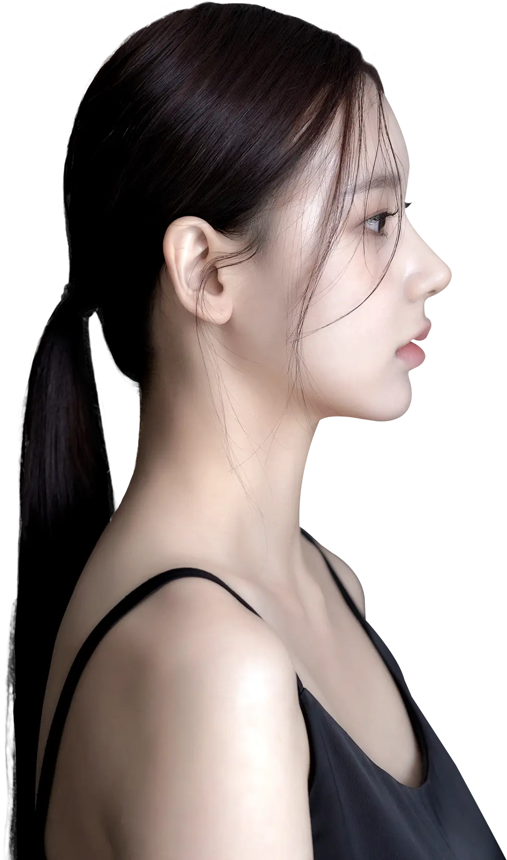 3D customized SOFIT rhinoplasty model