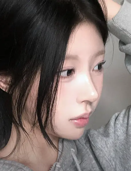 AB x SOFIT customized rhinoplasty 2