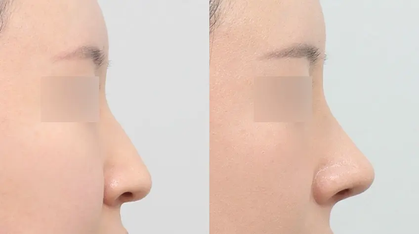 Thiết kế phù hợp với cấu trúc mũi Đầu mũi không bị chùng