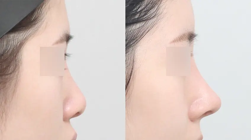 Thiết kế phù hợp với cấu trúc mũi Đầu mũi không bị chùng