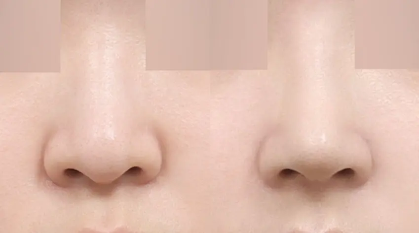 Đường trụ mũi cân đối , yếu tố quyết định độ hoàn thiện khi nhìn chính diện