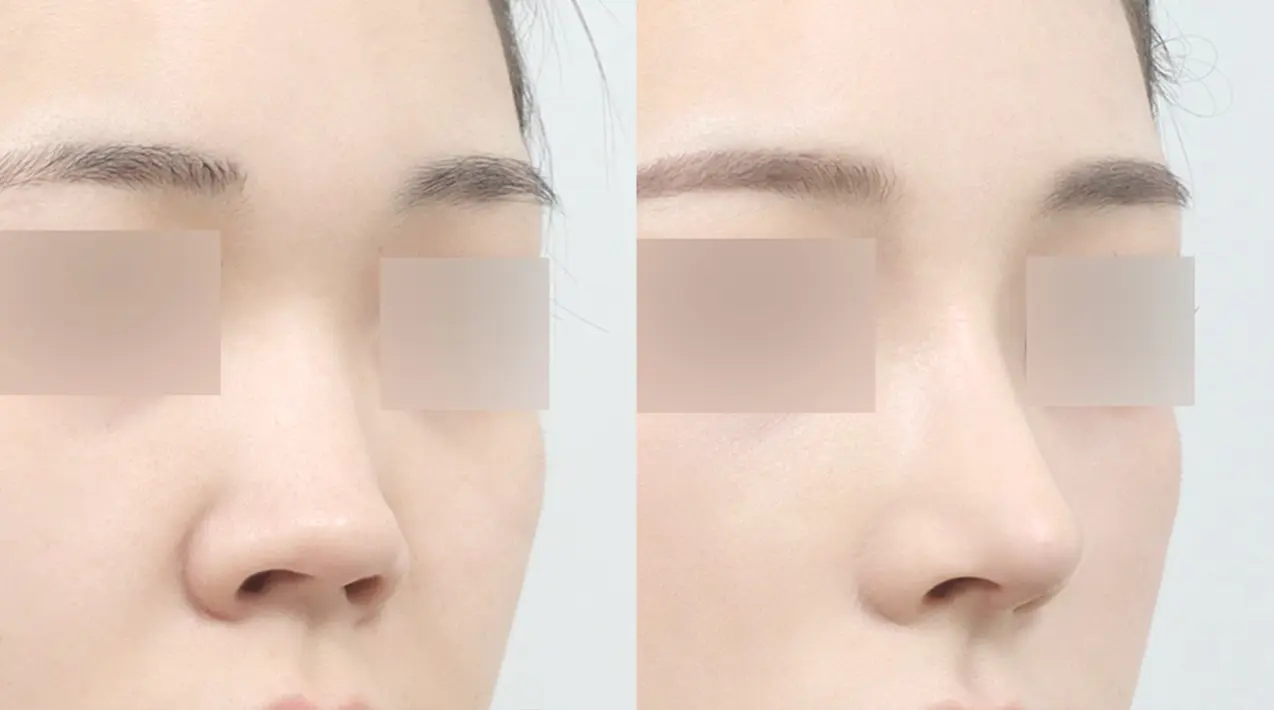 Đường sống mũi liền mạch mượt mà , ôm sát không tạo khoảng hở.