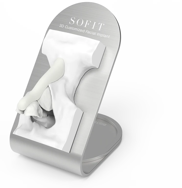 SOFIT 3D customized facial implant