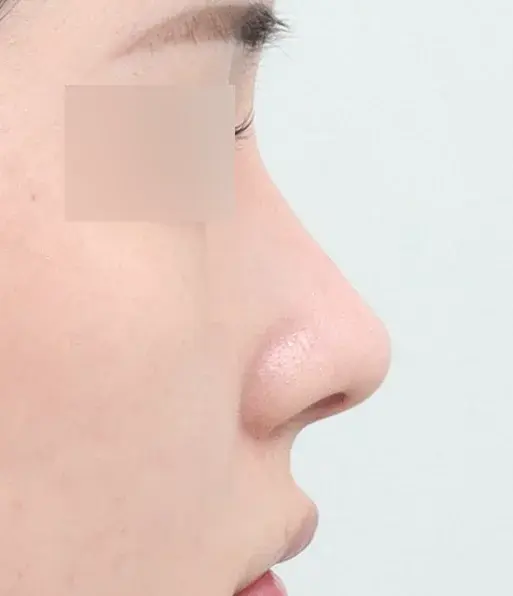 After 1 Month