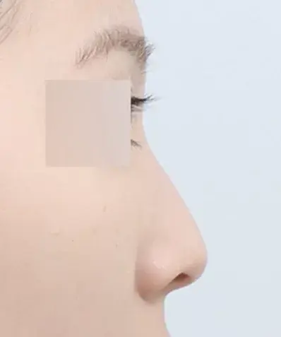 Precision