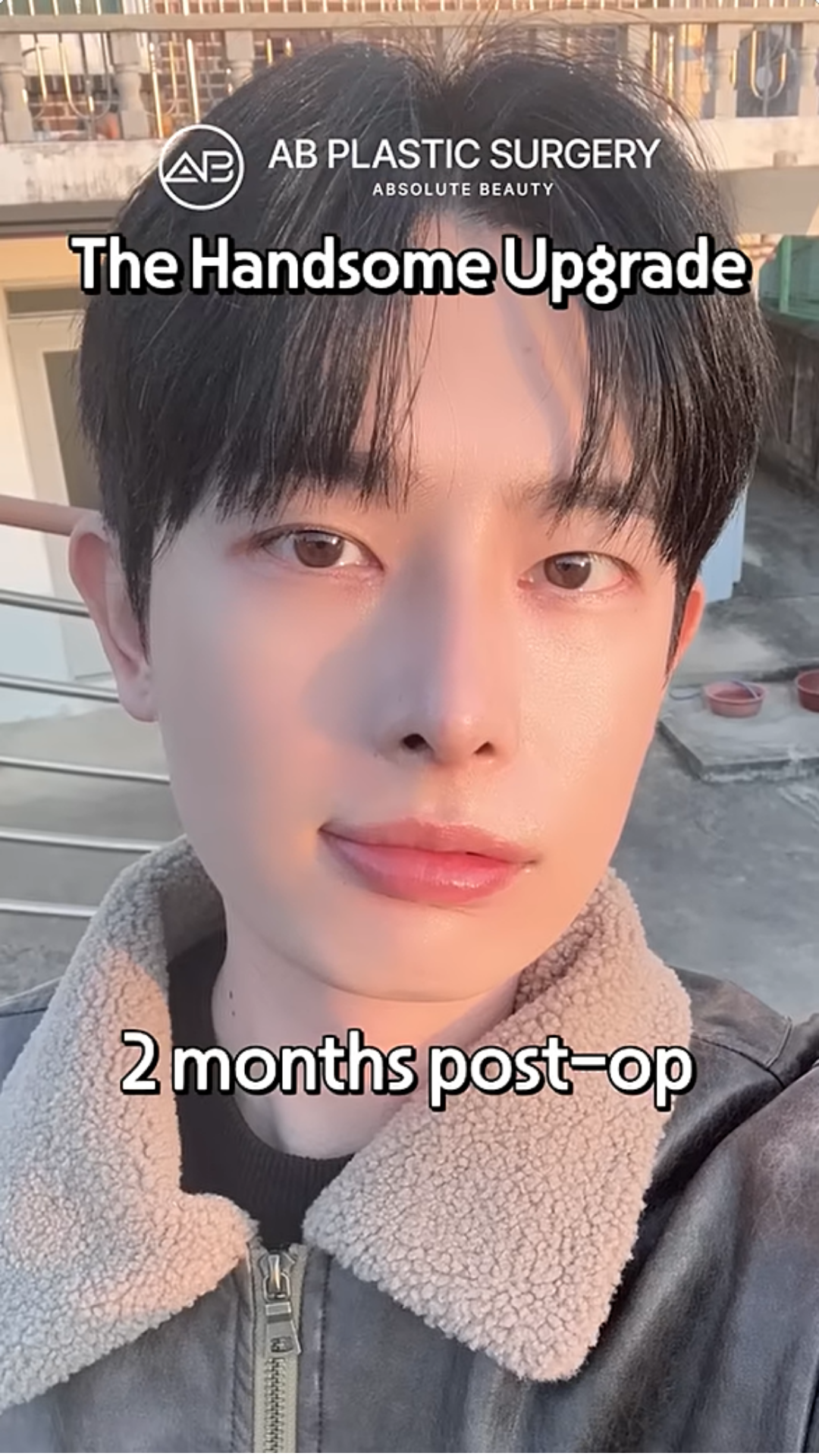 Nose & Eye Surgery Journey in Korea