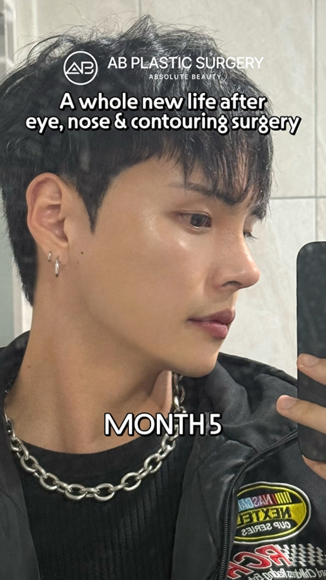 This Facial Surgery Changed His Whole Look