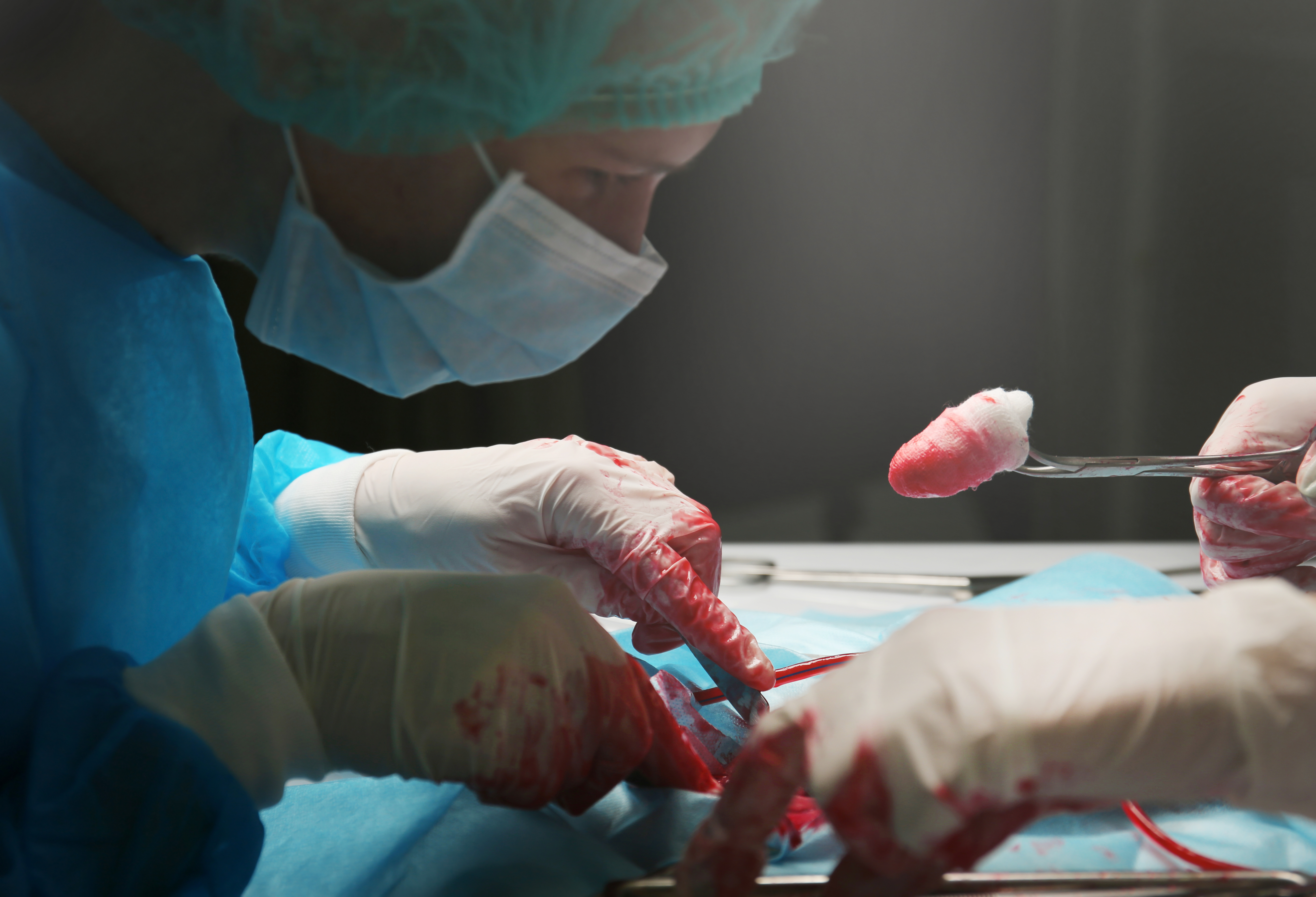 Main Risks of the Supplements During Plastic Surgery