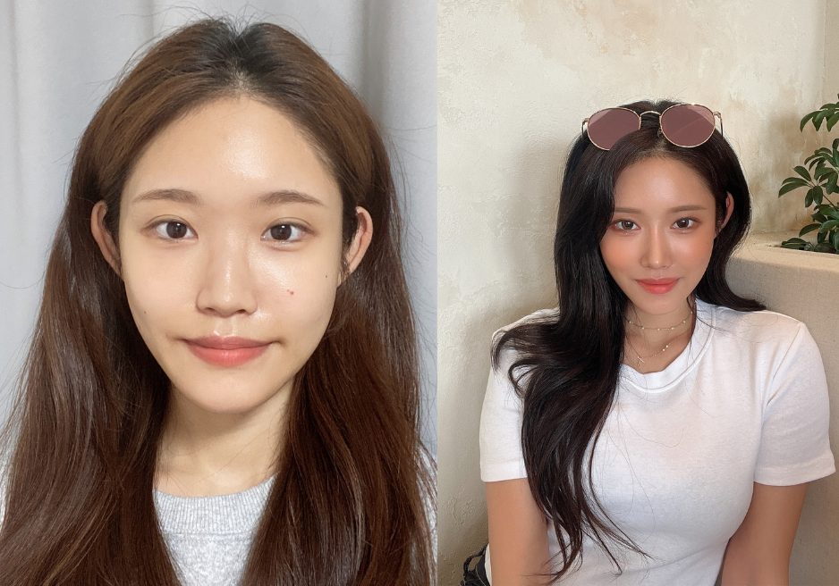 Real Patient Before and After