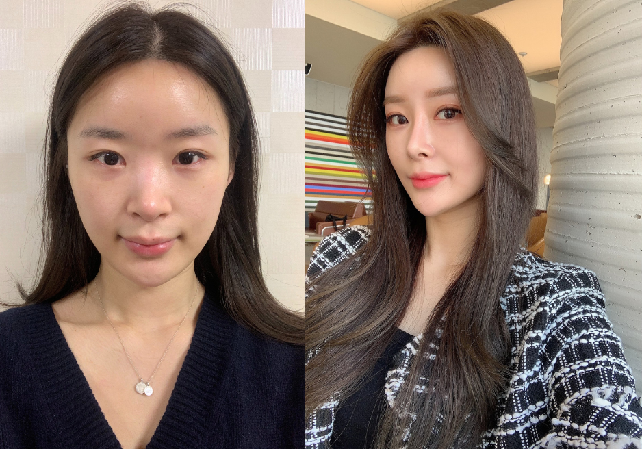 AB Plastic Surgery Korea