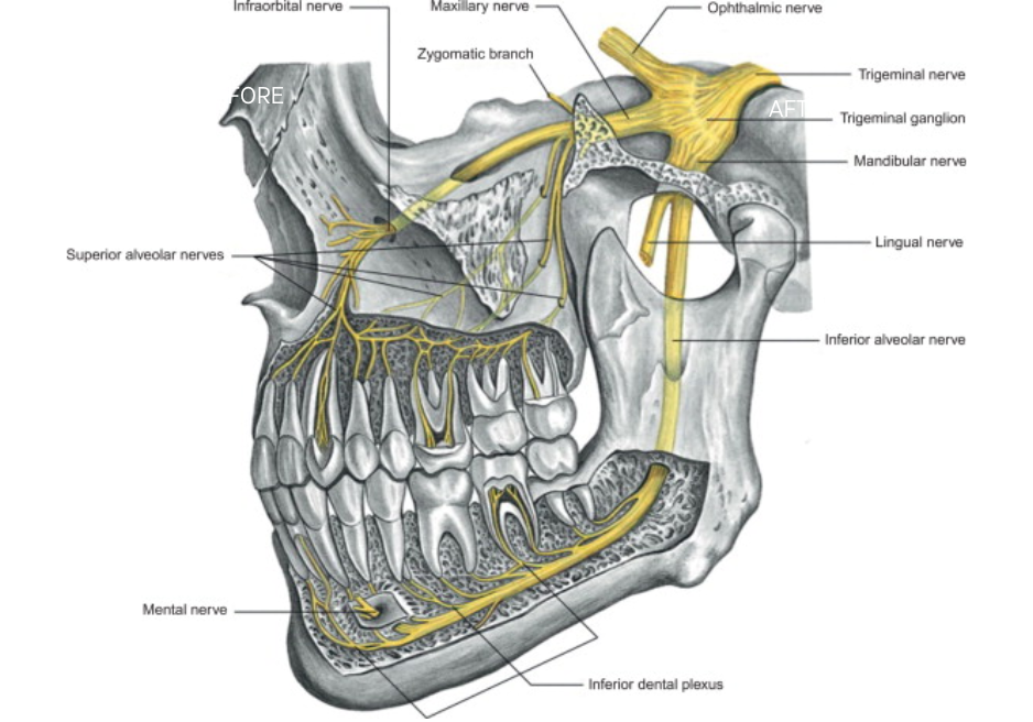 v-line-surgery-korea-alveolar-nerve-damage