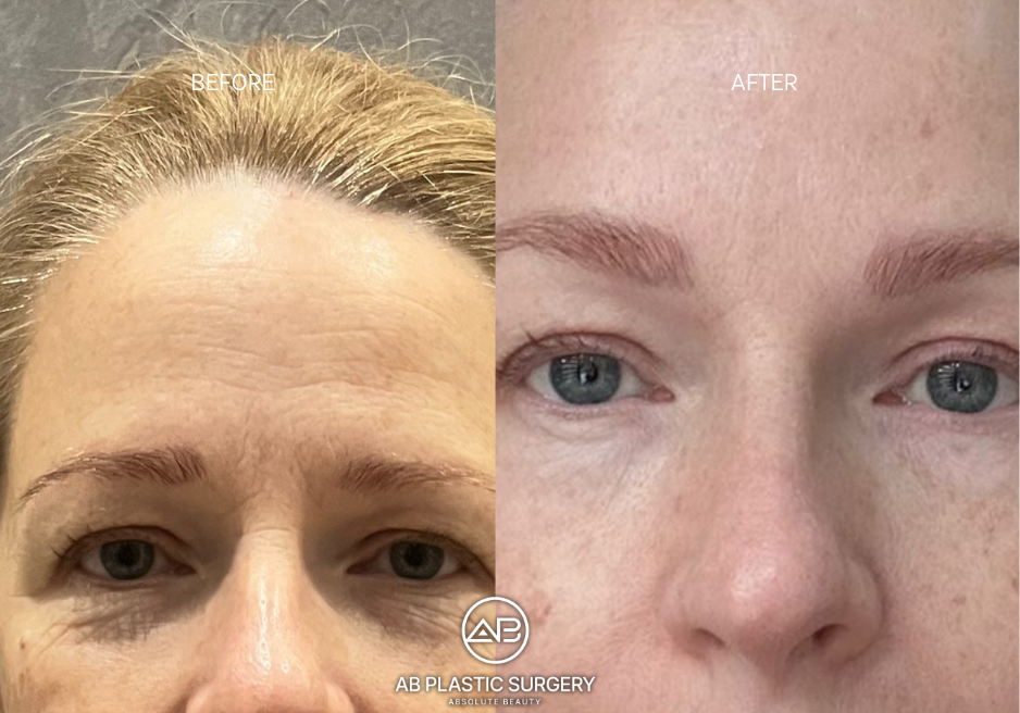 How-to-Choose-the-Right-korean-plastic-surgery-Clinic-Beyond-Google-Reviews