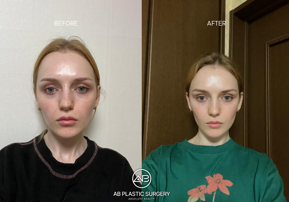 how-to-choose-best-time-of-the-year-for-the-plastic-surgery-in-korea