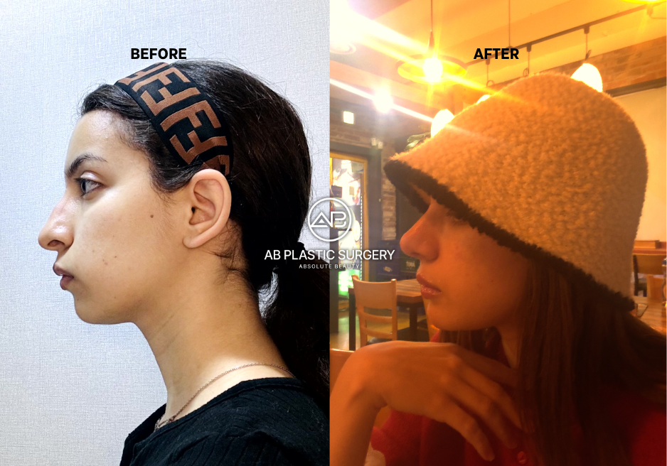 how-to-get-prepaired-for-plastic-surgery-in-korea