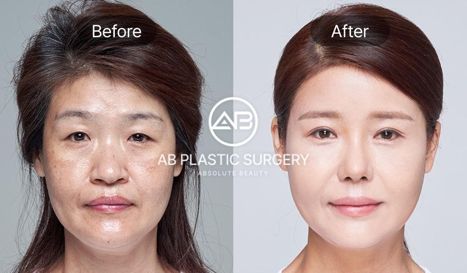 how-to-choose-the-right-clinic-for-plastic-surgery-in-korea