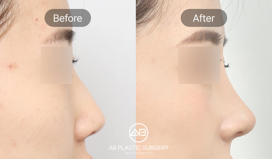 how-to-understand-that-plastic-surgery-hospital-tries-to-scam-you