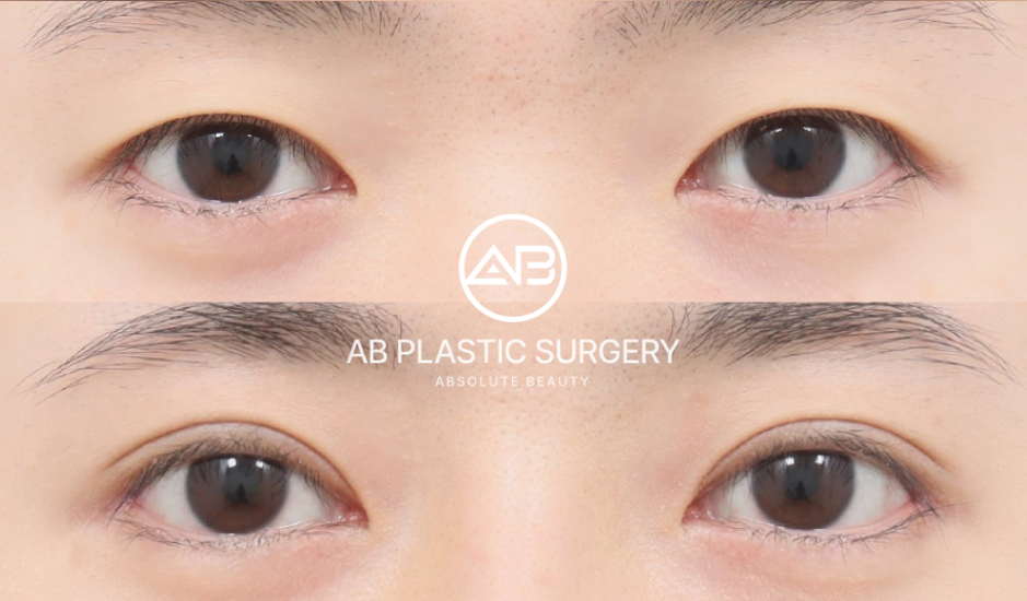 korean_beauty_standards_eyes