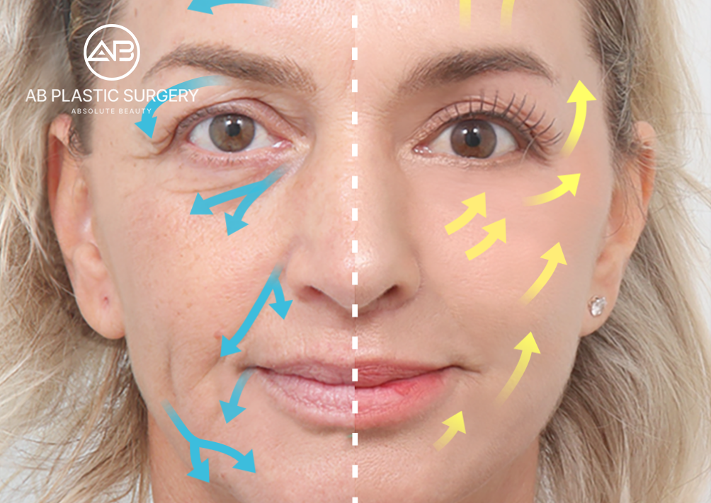 the-top-5-korean-facelift-techniques