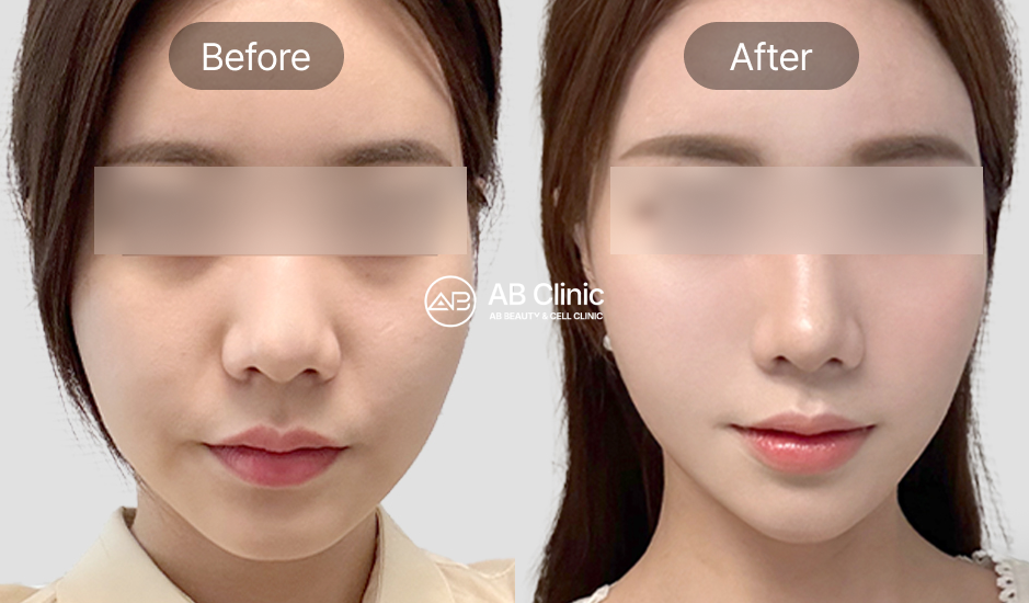 korean-beauty-treatments-for-skin-and-age-lines