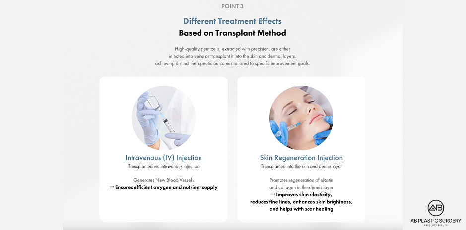AB Plastic Surgery Korea stem cell facial procedure