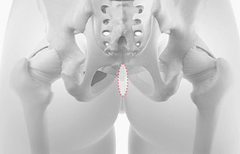 Autologous dermis rhinoplasty material