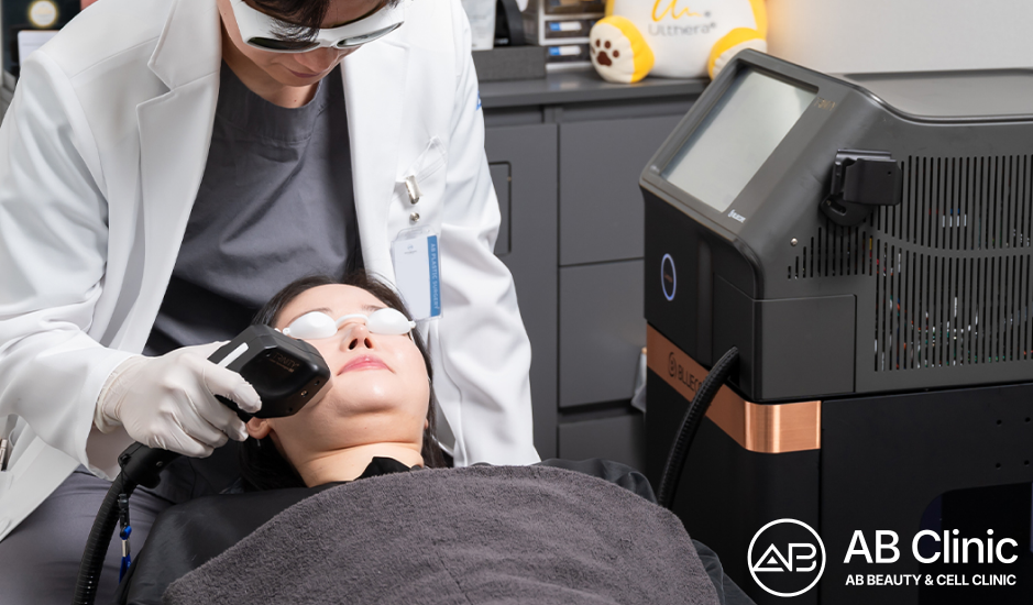 AB Clinic clinician performing laser treatment for facial redness and visible vessels associated with rosacea