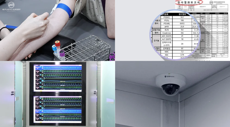 AB Plastic Surgery Korea safety system showing preoperative blood testing, real-time monitoring, and operating room CCTV