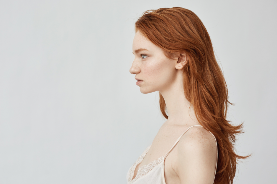 A side profile portrait of a red-haired woman against a plain background, illustrating an angle used for consultation photos