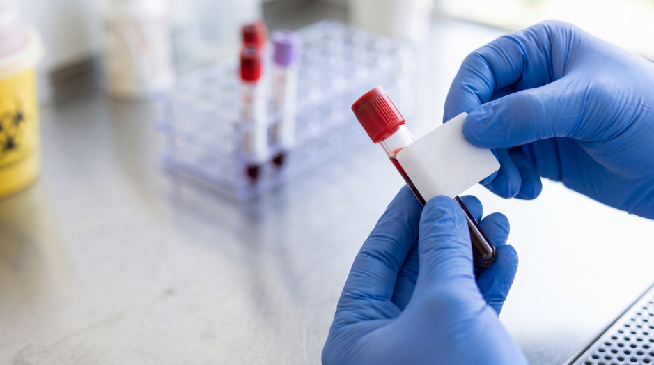 An AI-generated image of blue-gloved hands applying a label to a red-capped blood sample tube in a laboratory