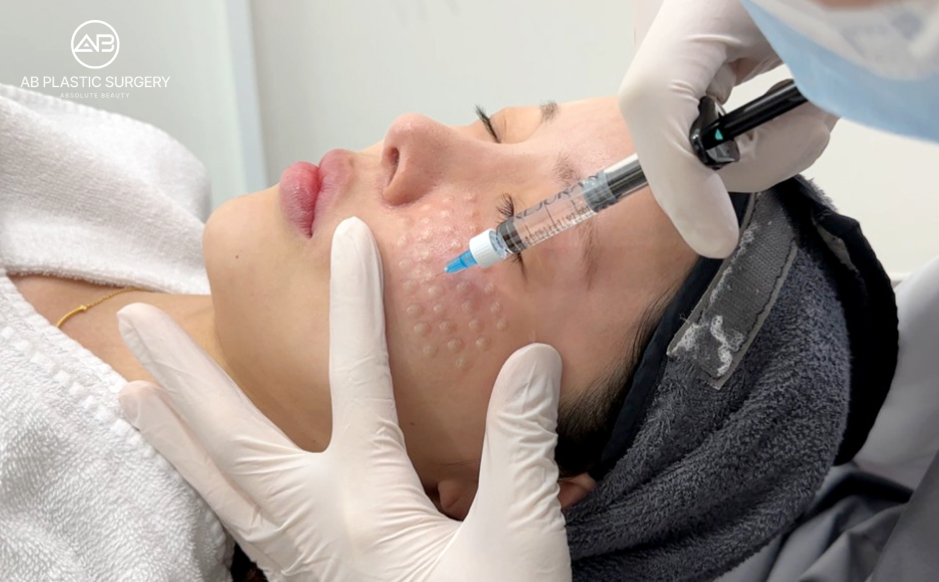 Medical skin treatment in Korea showing an injectable procedure performed after individual skin assessment