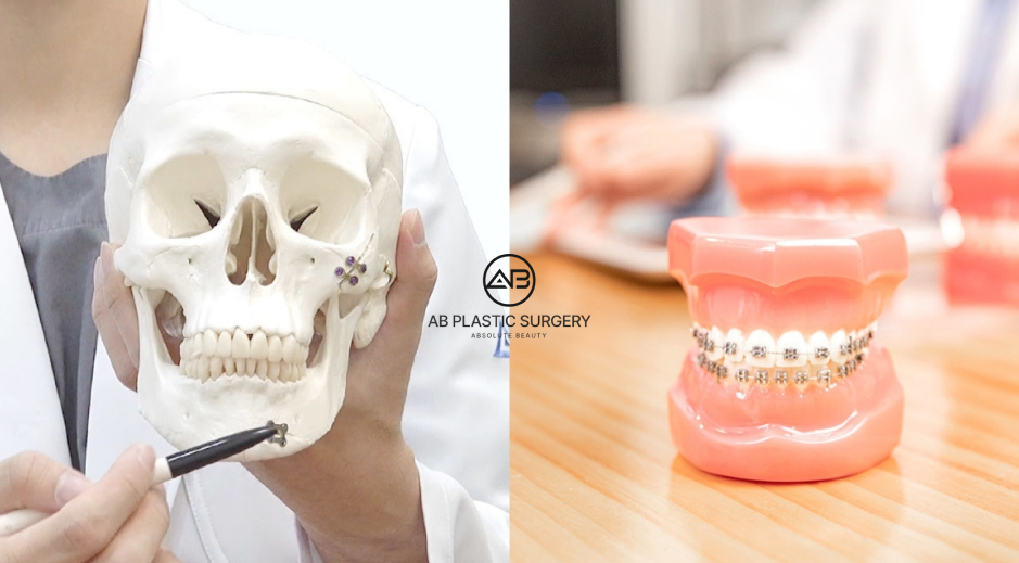 Preoperative facial contouring consultation using a skull model and dental model for surgical assessment and planning