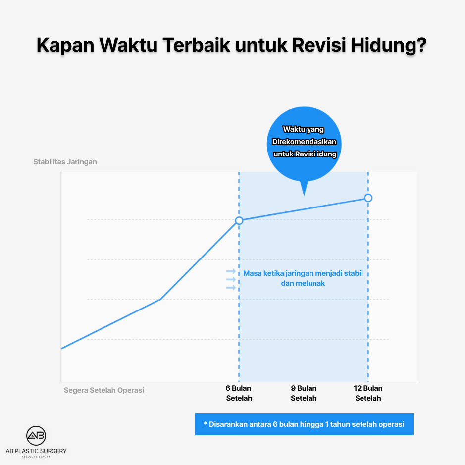 Grafik panduan waktu revisi hidung