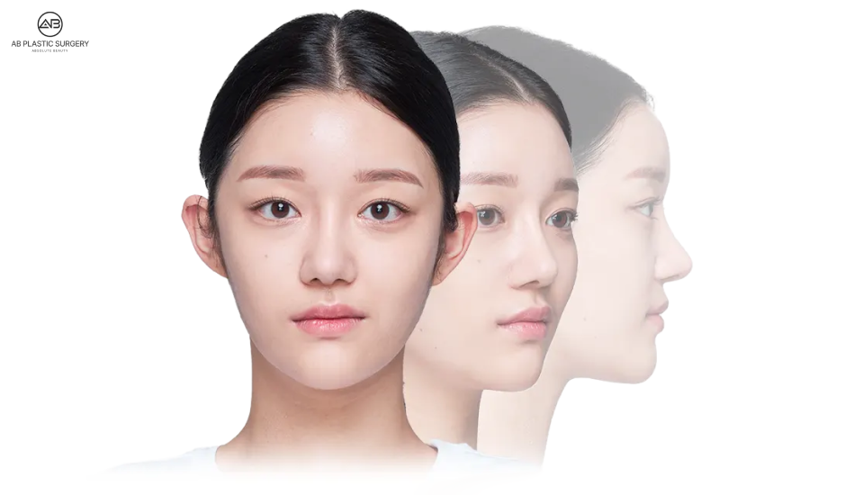 Analisis wajah dari berbagai sudut setelah koreksi hidung miring