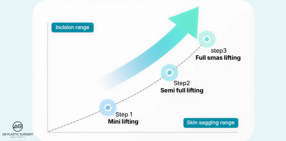 Diagram progres mini lifting, semi full lifting, hingga full SMAS lifting di Korea berdasarkan tingkat skin sagging