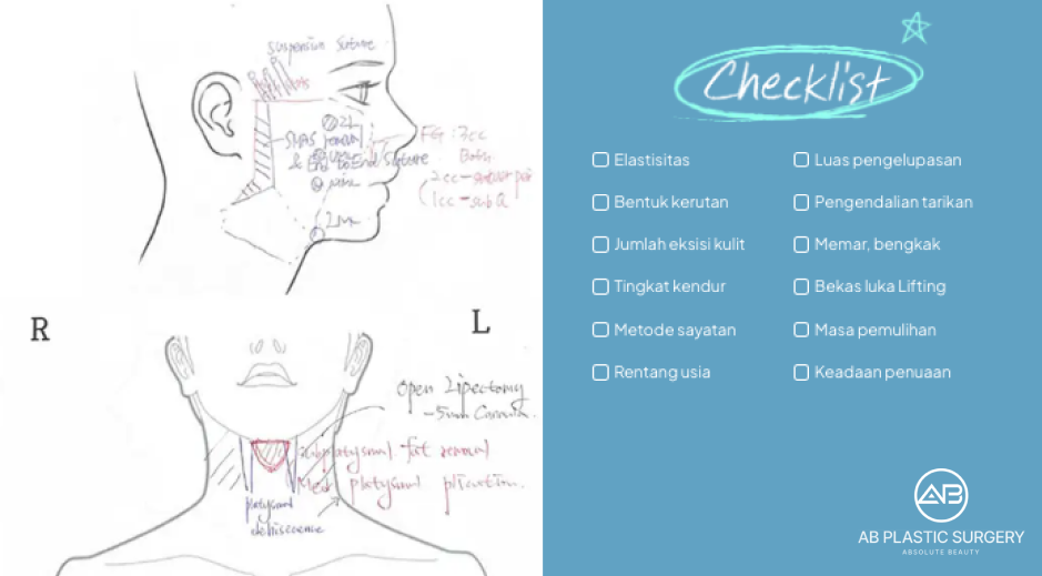 Diagram checklist evaluasi medis sebelum SMAS facelift di Korea untuk menilai tingkat pipi turun dan elastisitas kulit