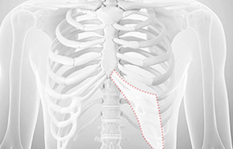 Tulang rawan iga untuk operasi hidung