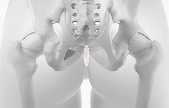 Dermis autologous untuk operasi hidung