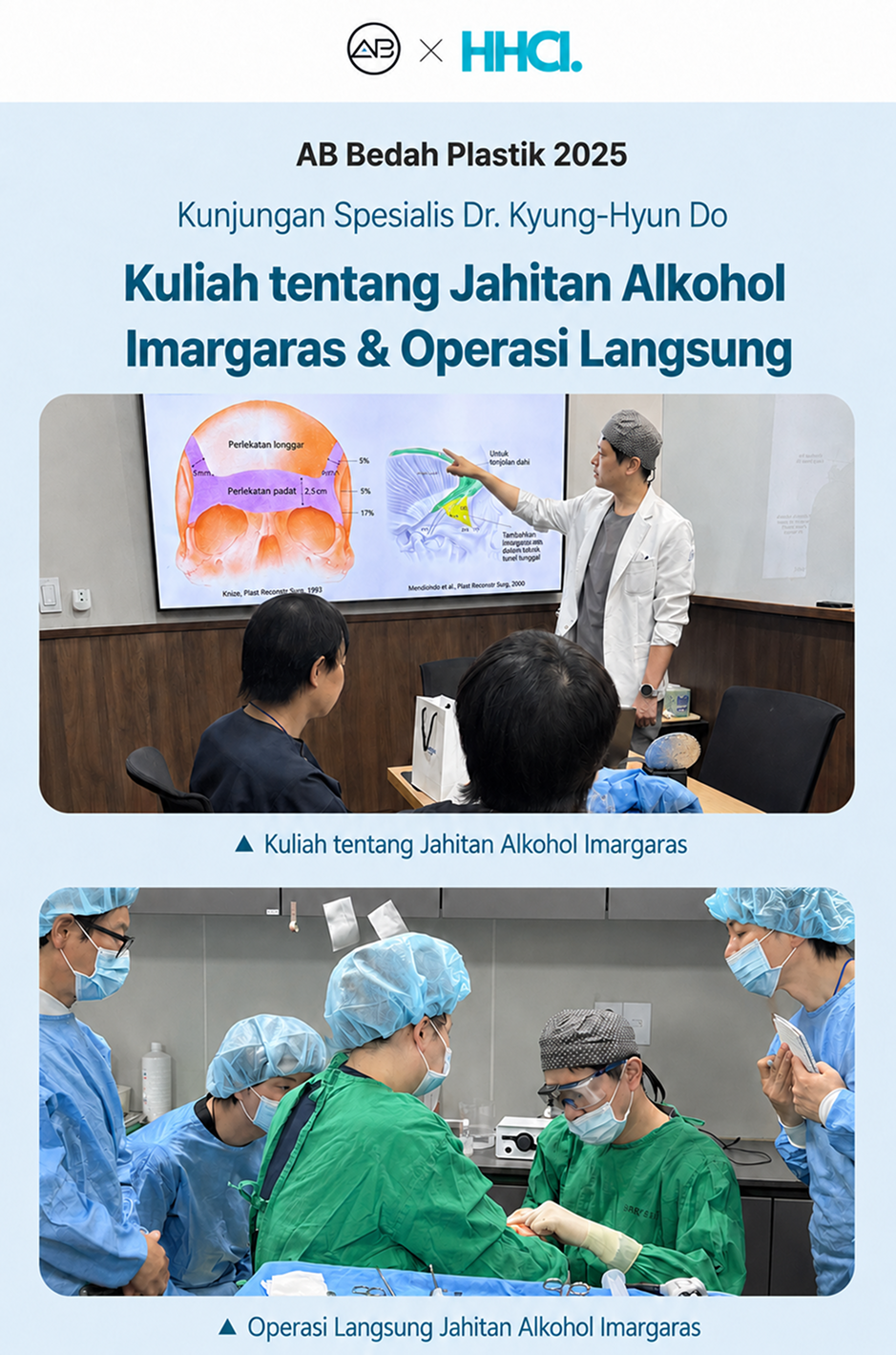 Program Pelatihan Medis Operasi Plastik AB Korea untuk Teknik Endoscopic Brow Lift dan Subbrow Lifting