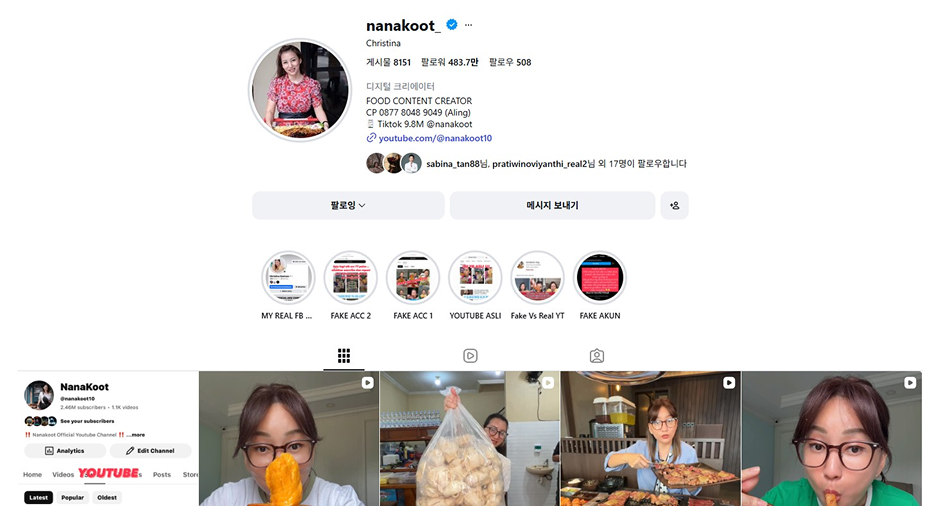 Profil Nanakoot Sebelum Menjalani Subbrow Lifting di Operasi Plastik AB Korea