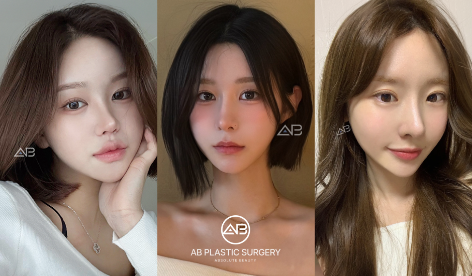 Kolase tiga potret wanita yang menunjukkan variasi bentuk wajah dan gaya kecantikan natural di Operasi Plastik AB Korea.