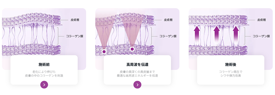 サーマクール原理