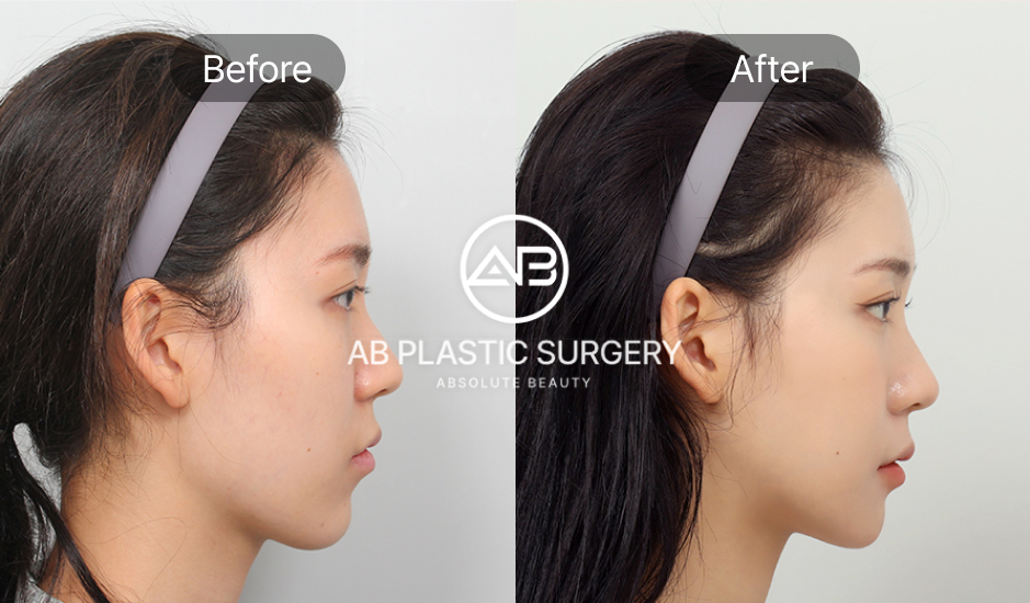 韓国の輪郭整形でおすすめの代表的な病院