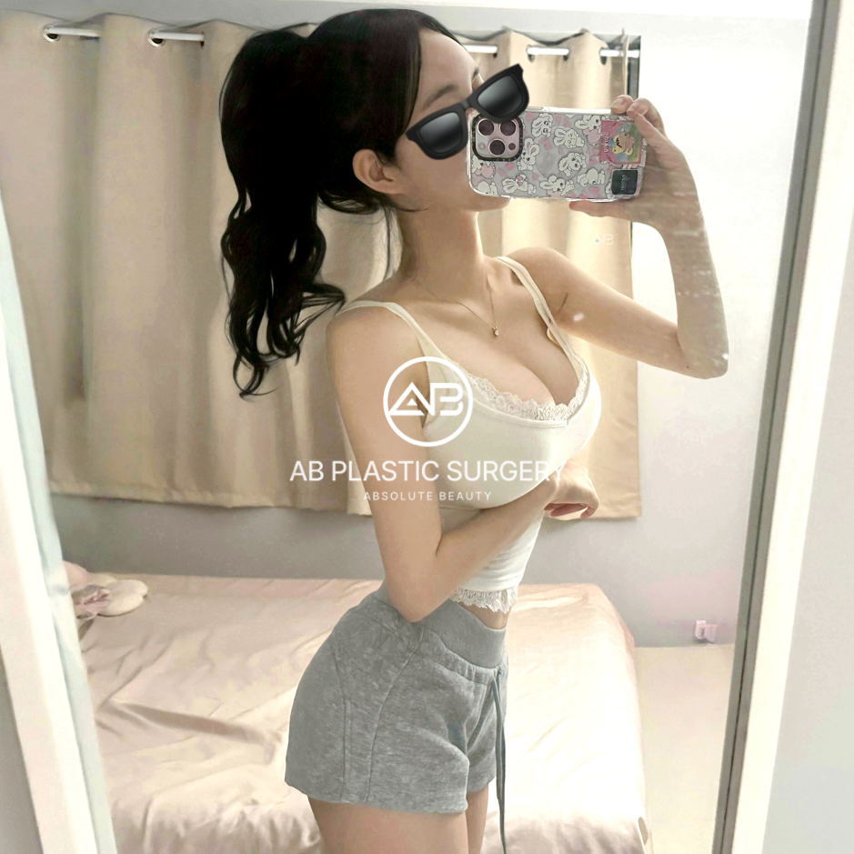 韓国豊胸リアルレビュー写真｜AB美容外科で施術を受けた患者のセルフィー。自然なバストラインと全身バランスを確認可能