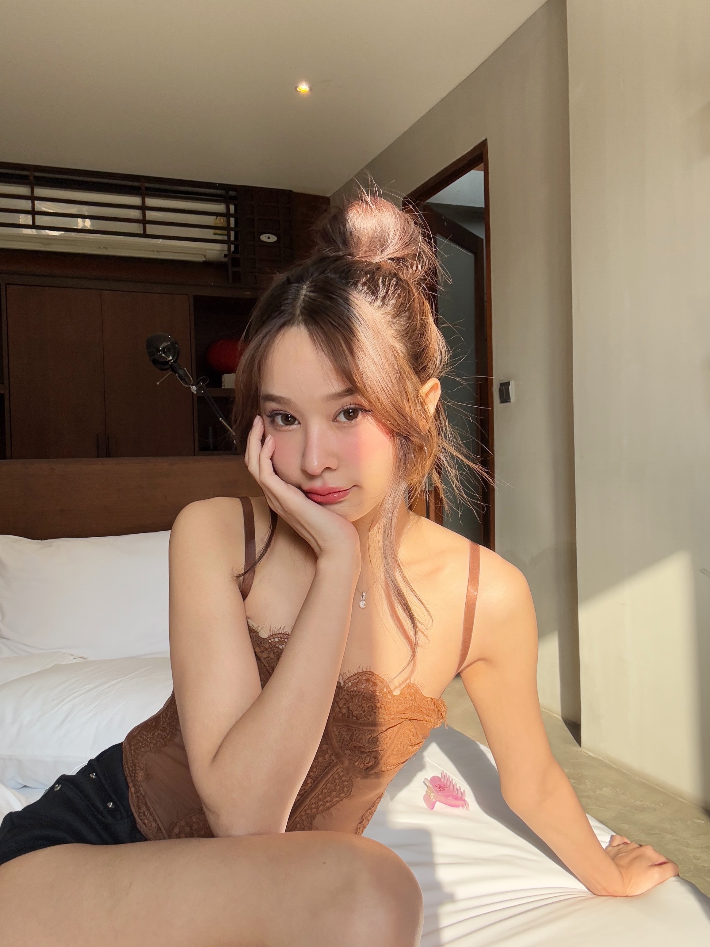 ศัลยกรรมเกาหลี Before & After - คุณบีม littlebeam หลังแก้จมูก ตาสองชั้น และเอนโดไทน์ ที่ AB Plastic Surgery