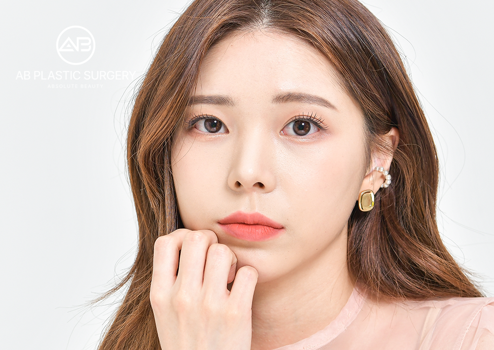 ผลลัพธ์หลังทำ Ulthera (อัลเทอร่า)