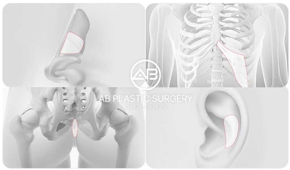  ใช้เสริมจมูก:  กระดูกอ่อนหลังหู กระดูกอ่อนซี่โครง กระดูกอ่อนผนังกั้นจมูก ผิวหนังชั้นหนังแท้บริเวณก้นกบ 