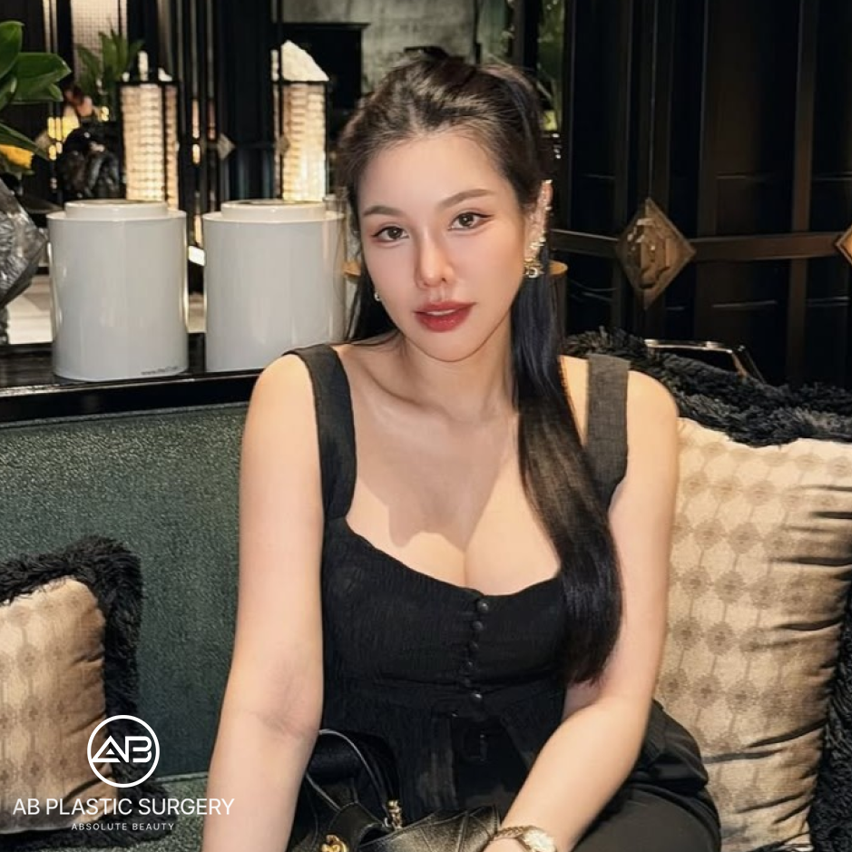 ภาพคุณ Faii Am Fine หลังทำการดึงหน้าแบบ SMAS ที่เกาหลีโรงพยาบาลศัลยกรรมAB ใบหน้าดูกระชับ กรอบหน้าชัดเจน และภาพรวมดูอ่อนเยาว์ลง